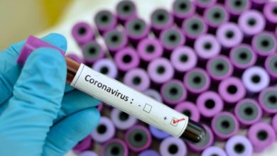 Frasco com amostra do Coronavirus - Fonte: Imagem da Internet